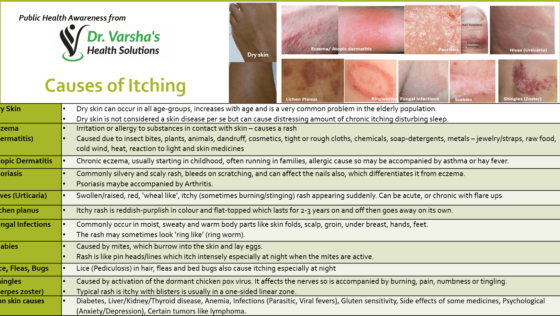 ITCHING_-Causes