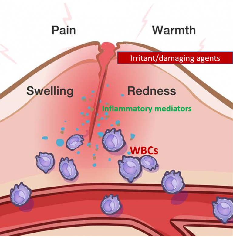 Inflammation and Allergy Body's reactions and responses